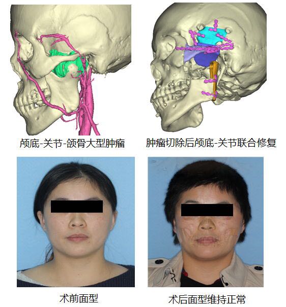 上海市颞颌关节病及颌面畸形诊治专业技术服务平台